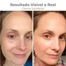 MASSAGEADOR FACIAL ANTI RUGAS LIFTING