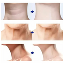 MASSAGEADOR FACIAL ANTI RUGAS LIFTING